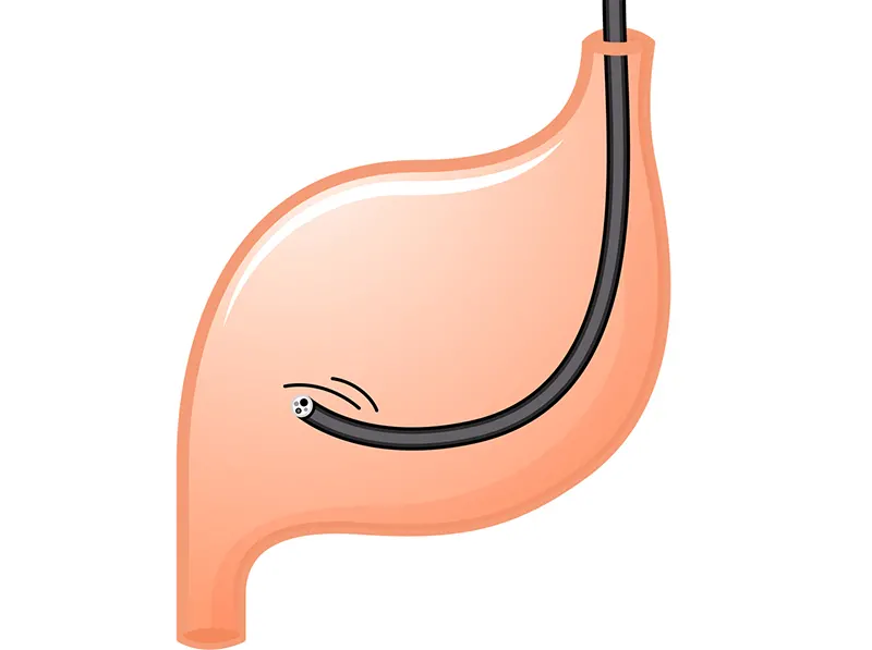 胃･大腸内視鏡イメージ
